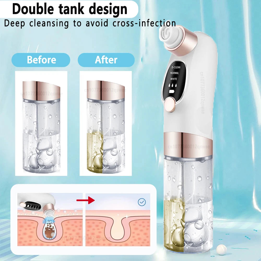Electric Blackhead Remover Pore Vacuum – Deep Cleansing Face Tool with Water Cycle & USB Recharge | Acne & Blackhead Suction Device