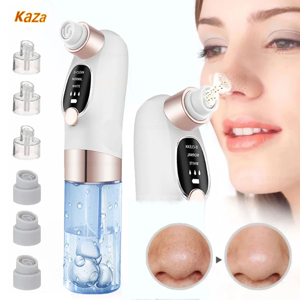 Electric Blackhead Remover Pore Vacuum – Deep Cleansing Face Tool with Water Cycle & USB Recharge | Acne & Blackhead Suction Device