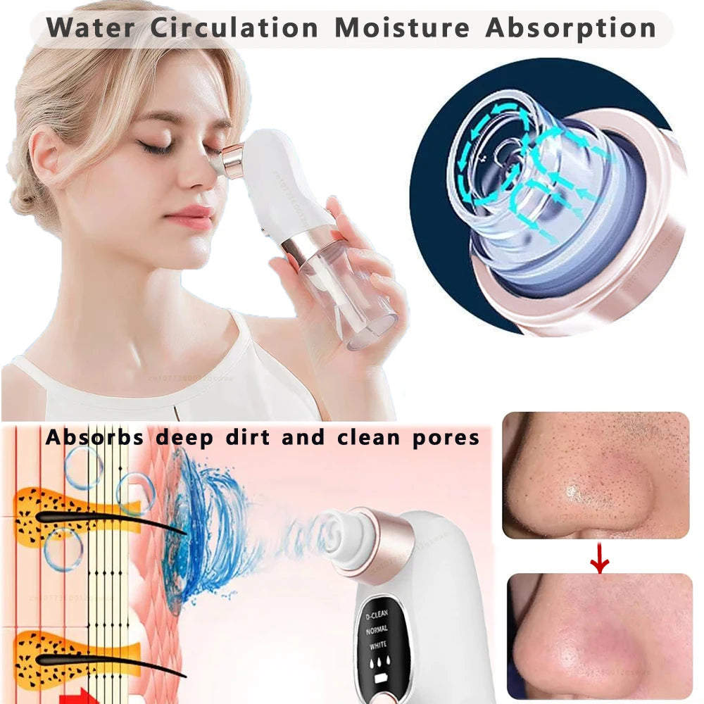 Electric Blackhead Remover Pore Vacuum – Deep Cleansing Face Tool with Water Cycle & USB Recharge | Acne & Blackhead Suction Device