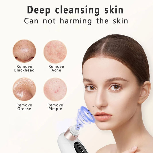 Electric Blackhead Remover Pore Vacuum – Deep Cleansing Face Tool with Water Cycle & USB Recharge | Acne & Blackhead Suction Device